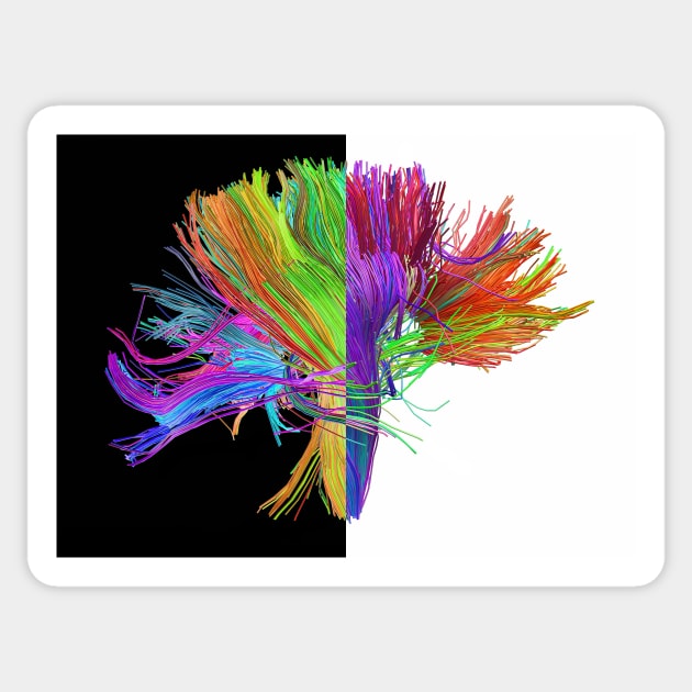 White matter fibres of the human brain (C023/9416) Sticker by SciencePhoto